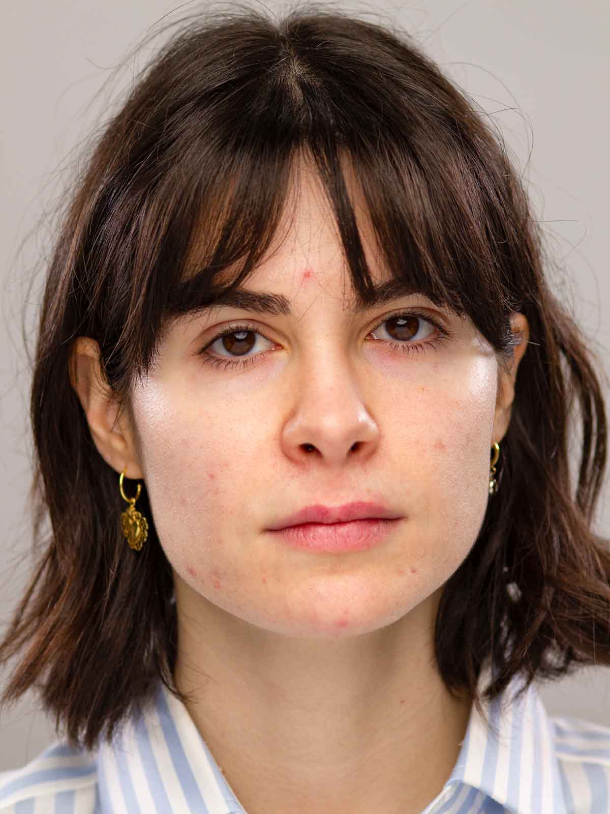 Woman before applying Lebubè hydrating skin tint with spf 30, with visible redness, discoloration, acne and blemishes