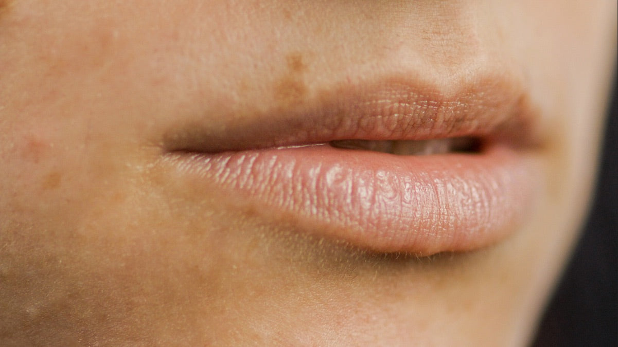 Close-up of a woman's dry and damaged lips before wearing Lebubè hydrating and repairing lip oil & balm with skincare actives